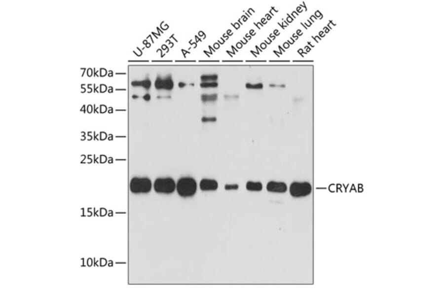Western Blot - Anti-Alpha B Crystallin Antibody (A88702) - Antibodies.com