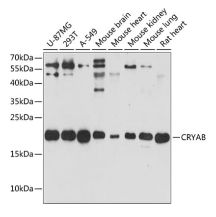 Western Blot - Anti-Alpha B Crystallin Antibody (A88702) - Antibodies.com