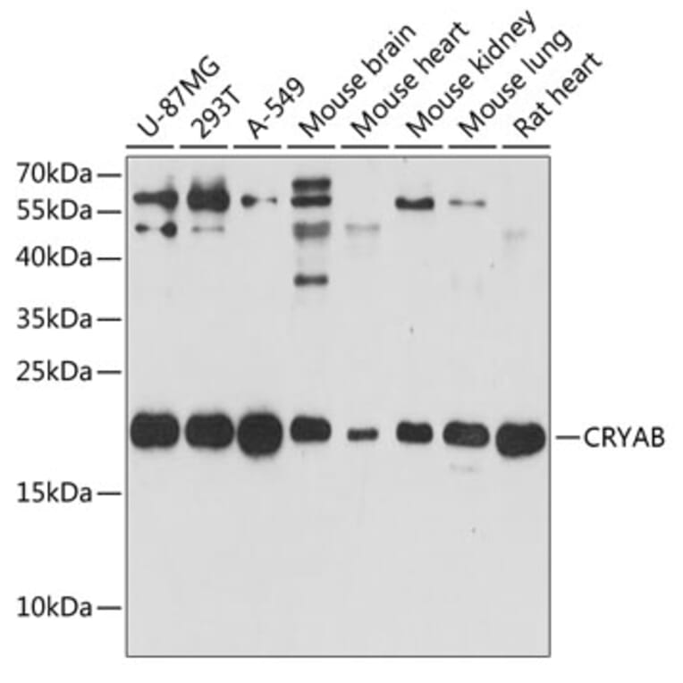 Western Blot - Anti-Alpha B Crystallin Antibody (A88702) - Antibodies.com