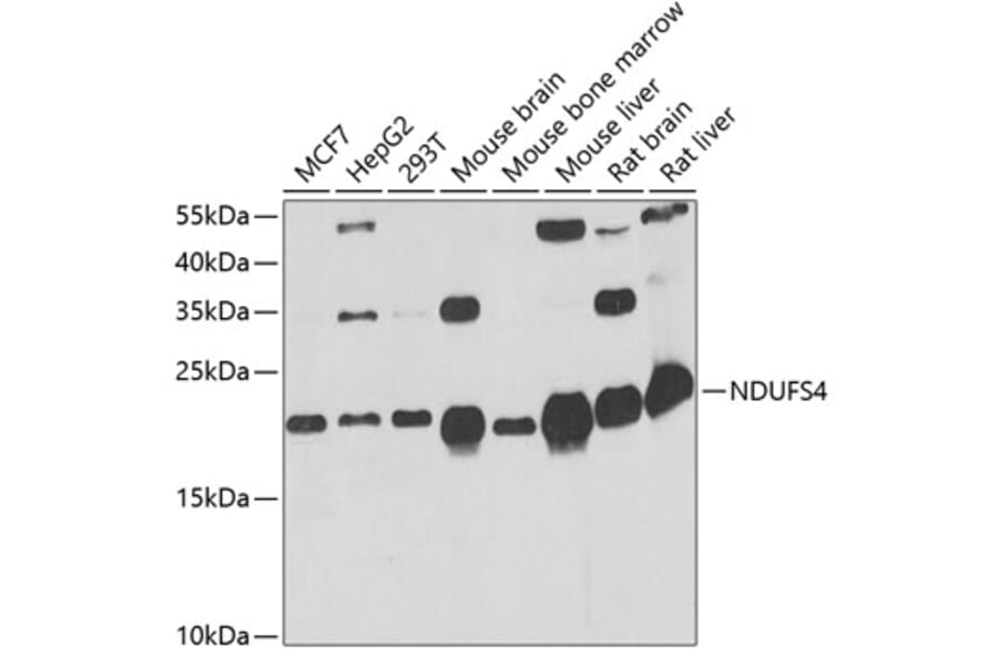 Western Blot - Anti-Ndufs4 Antibody (A88703) - Antibodies.com