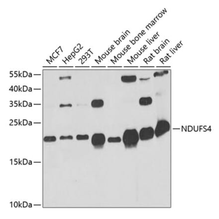 Western Blot - Anti-Ndufs4 Antibody (A88703) - Antibodies.com