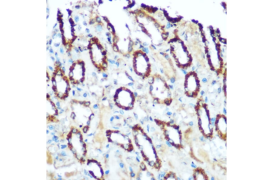 Immunohistochemistry - Anti-Ndufs4 Antibody (A88703) - Antibodies.com