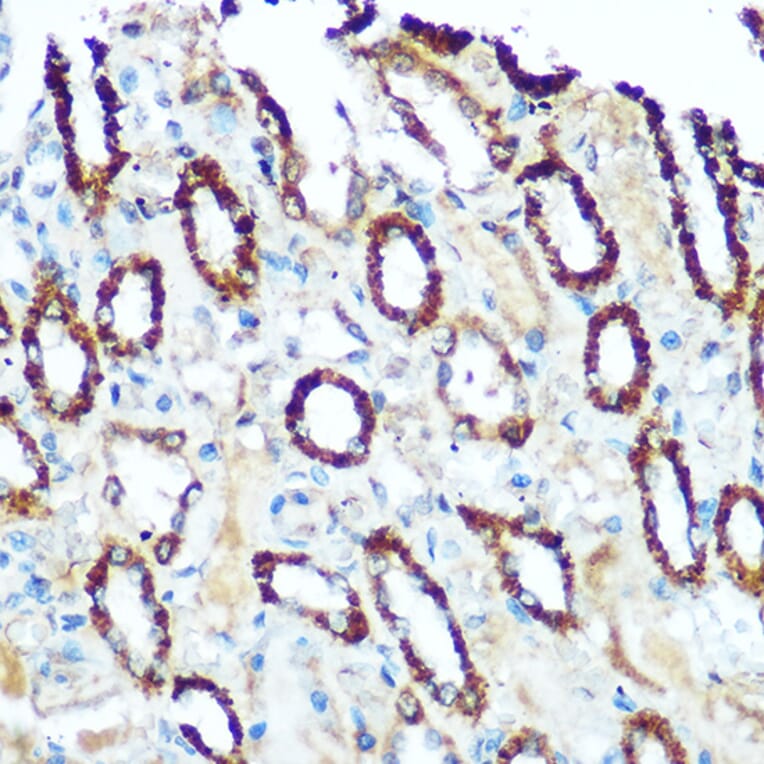 Immunohistochemistry - Anti-Ndufs4 Antibody (A88703) - Antibodies.com