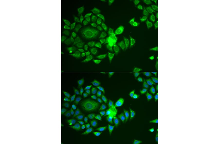 Immunofluorescence - Anti-Ndufs4 Antibody (A88703) - Antibodies.com