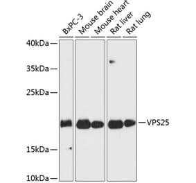 Western Blot - Anti-VPS25 Antibody (A88704) - Antibodies.com