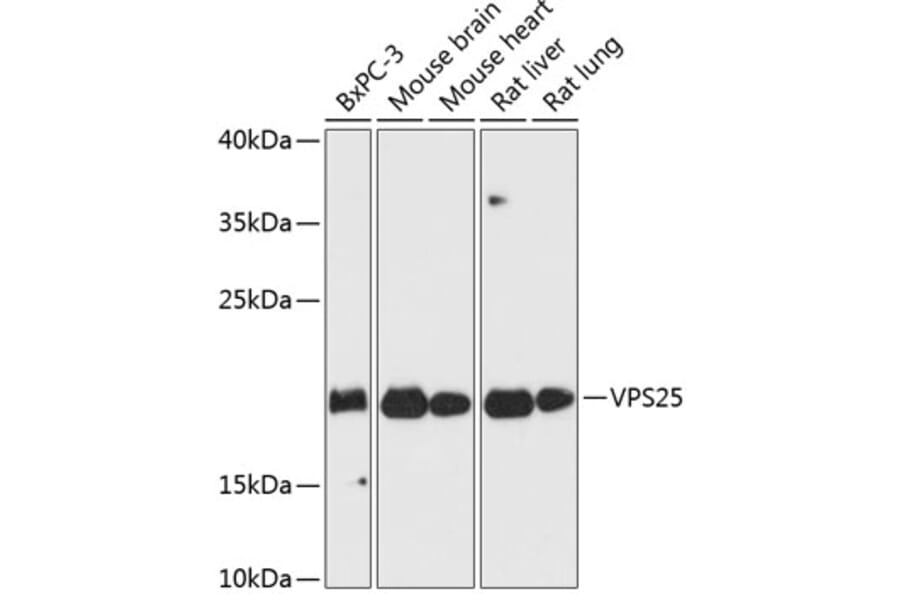 Western Blot - Anti-VPS25 Antibody (A88704) - Antibodies.com
