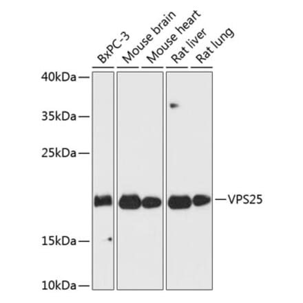 Western Blot - Anti-VPS25 Antibody (A88704) - Antibodies.com