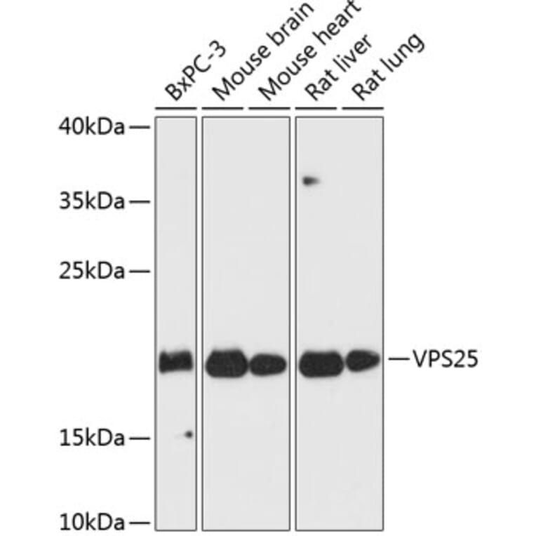 Western Blot - Anti-VPS25 Antibody (A88704) - Antibodies.com