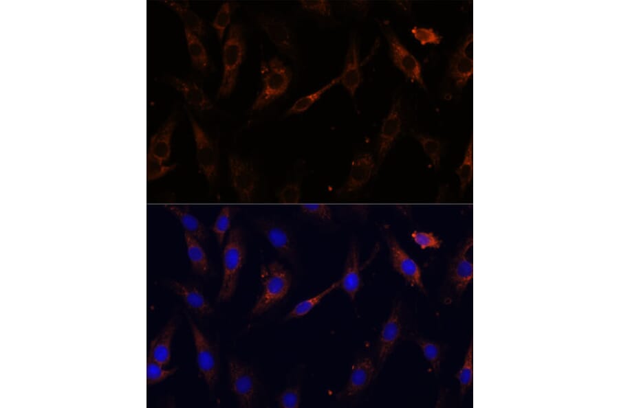 Immunofluorescence - Anti-VPS25 Antibody (A88704) - Antibodies.com