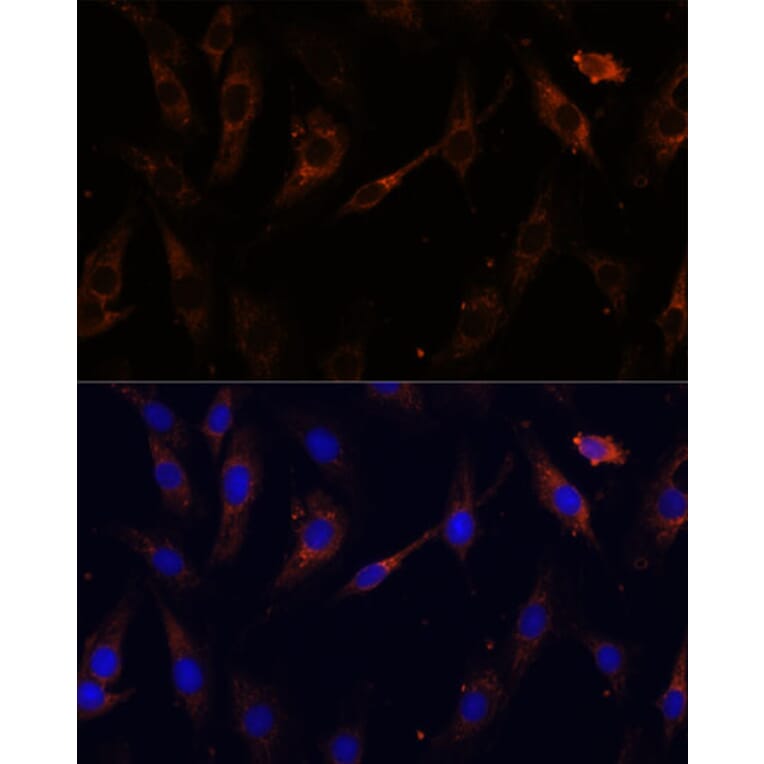 Immunofluorescence - Anti-VPS25 Antibody (A88704) - Antibodies.com