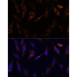 Immunofluorescence - Anti-VPS25 Antibody (A88704) - Antibodies.com