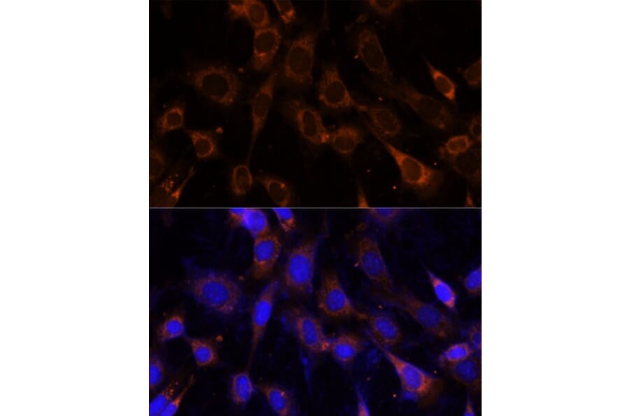 Immunofluorescence - Anti-VPS25 Antibody (A88704) - Antibodies.com