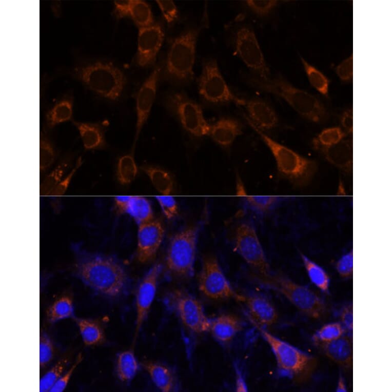 Immunofluorescence - Anti-VPS25 Antibody (A88704) - Antibodies.com