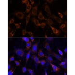 Immunofluorescence - Anti-VPS25 Antibody (A88704) - Antibodies.com