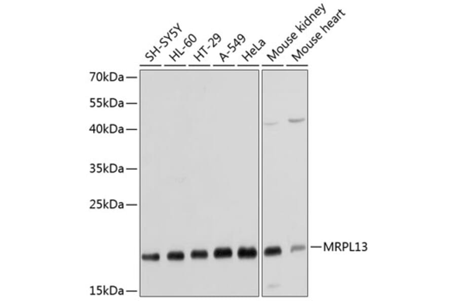 Western Blot - Anti-MRPL13 Antibody (A14122) - Antibodies.com
