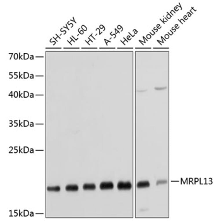 Western Blot - Anti-MRPL13 Antibody (A14122) - Antibodies.com