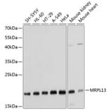 Western Blot - Anti-MRPL13 Antibody (A14122) - Antibodies.com