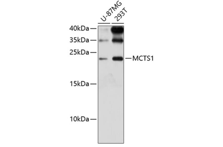 Western Blot - Anti-MCTS1/MCT-1 Antibody (A88706) - Antibodies.com