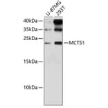 Western Blot - Anti-MCTS1/MCT-1 Antibody (A88706) - Antibodies.com