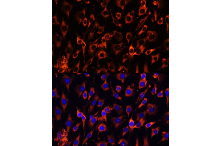 Immunofluorescence - Anti-MCTS1/MCT-1 Antibody (A88706) - Antibodies.com