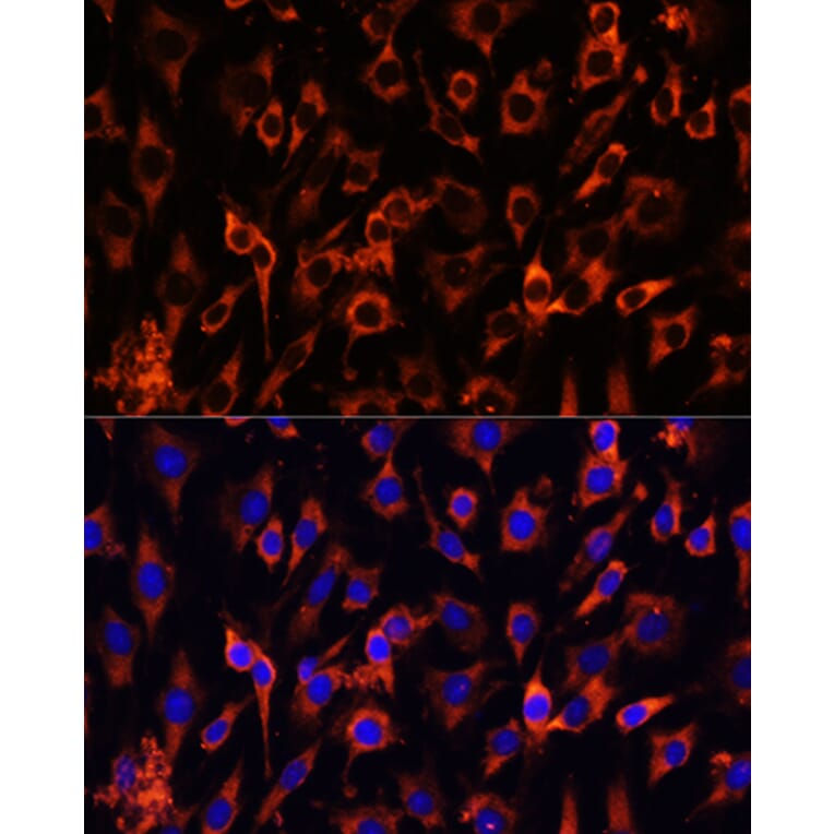 Immunofluorescence - Anti-MCTS1/MCT-1 Antibody (A88706) - Antibodies.com