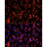 Immunofluorescence - Anti-MCTS1/MCT-1 Antibody (A88706) - Antibodies.com