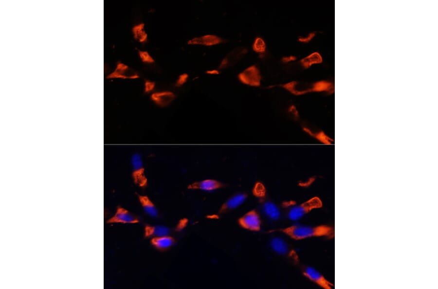 Immunofluorescence - Anti-MCTS1/MCT-1 Antibody (A88706) - Antibodies.com