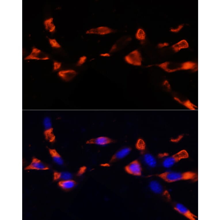 Immunofluorescence - Anti-MCTS1/MCT-1 Antibody (A88706) - Antibodies.com