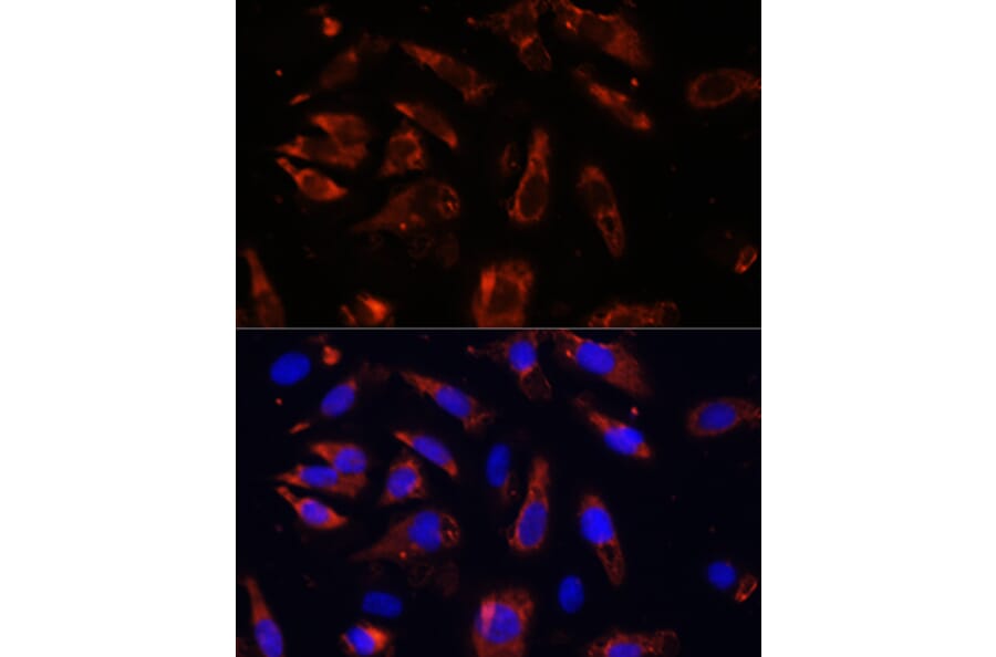 Immunofluorescence - Anti-MCTS1/MCT-1 Antibody (A88706) - Antibodies.com