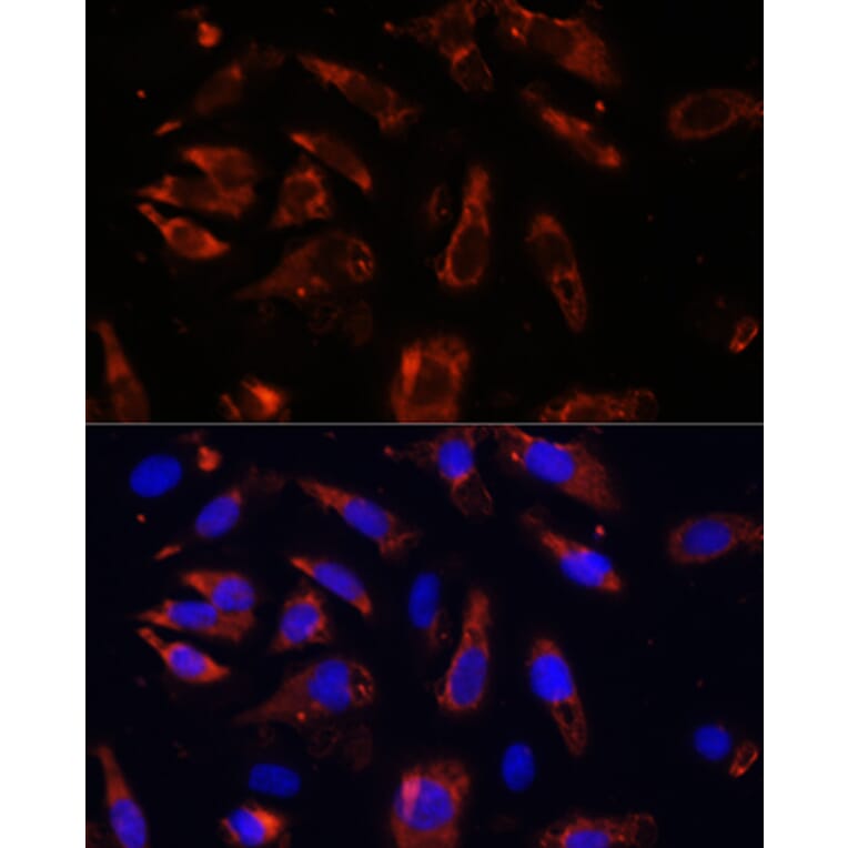 Immunofluorescence - Anti-MCTS1/MCT-1 Antibody (A88706) - Antibodies.com