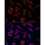 Immunofluorescence - Anti-MCTS1/MCT-1 Antibody (A88706) - Antibodies.com
