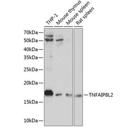 Western Blot - Anti-TIPE2 Antibody (A88707) - Antibodies.com