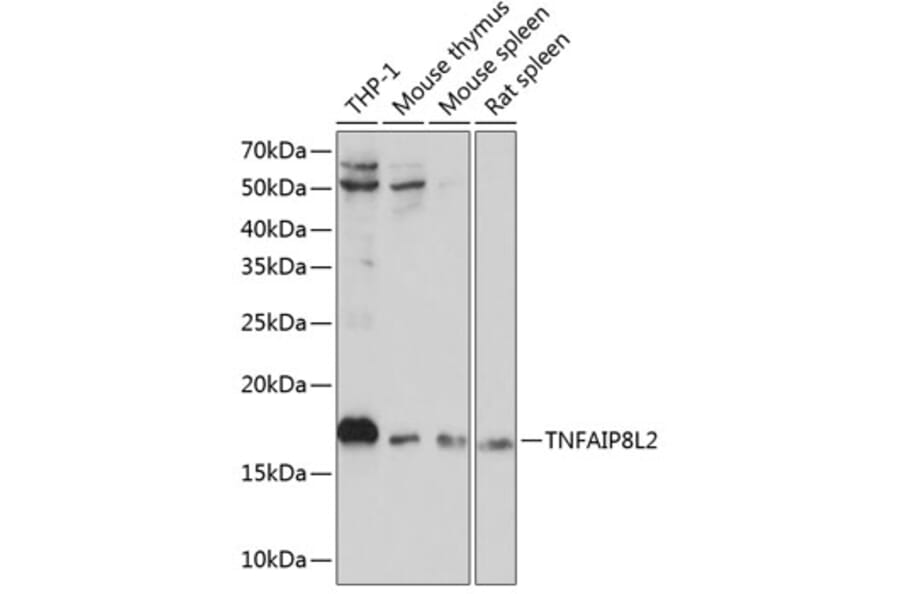 Western Blot - Anti-TIPE2 Antibody (A88707) - Antibodies.com