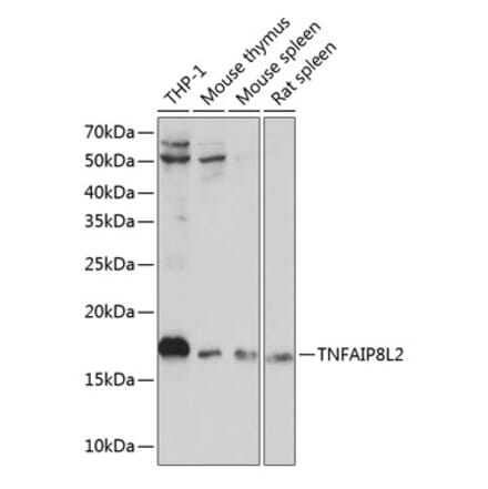 Western Blot - Anti-TIPE2 Antibody (A88707) - Antibodies.com