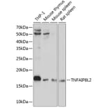 Western Blot - Anti-TIPE2 Antibody (A88707) - Antibodies.com