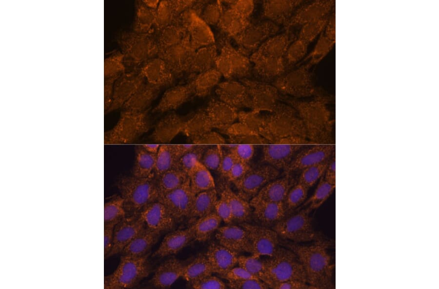 Immunofluorescence - Anti-TIPE2 Antibody (A88707) - Antibodies.com