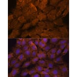 Immunofluorescence - Anti-TIPE2 Antibody (A88707) - Antibodies.com