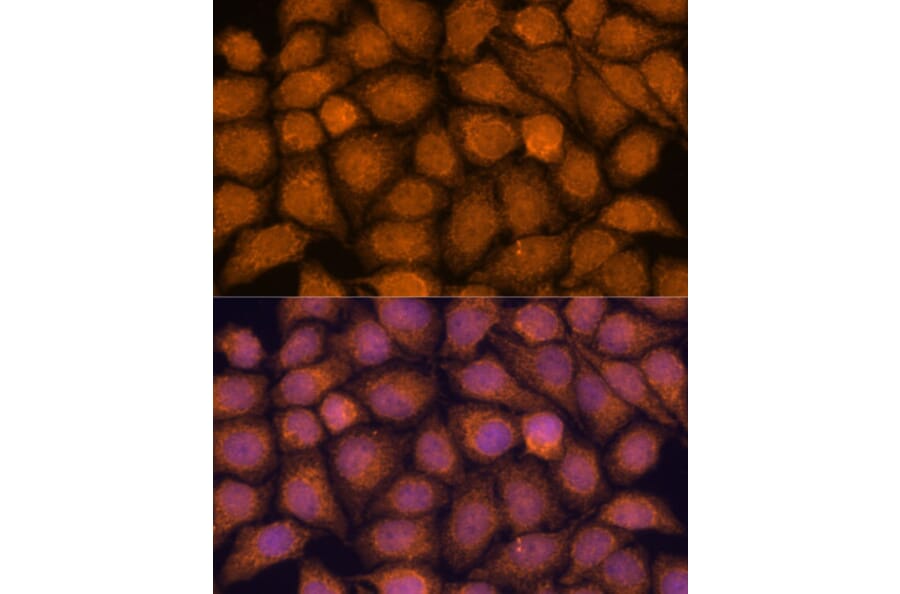 Immunofluorescence - Anti-TIPE2 Antibody (A88707) - Antibodies.com