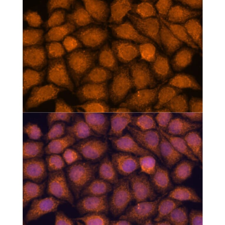 Immunofluorescence - Anti-TIPE2 Antibody (A88707) - Antibodies.com
