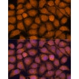 Immunofluorescence - Anti-TIPE2 Antibody (A88707) - Antibodies.com