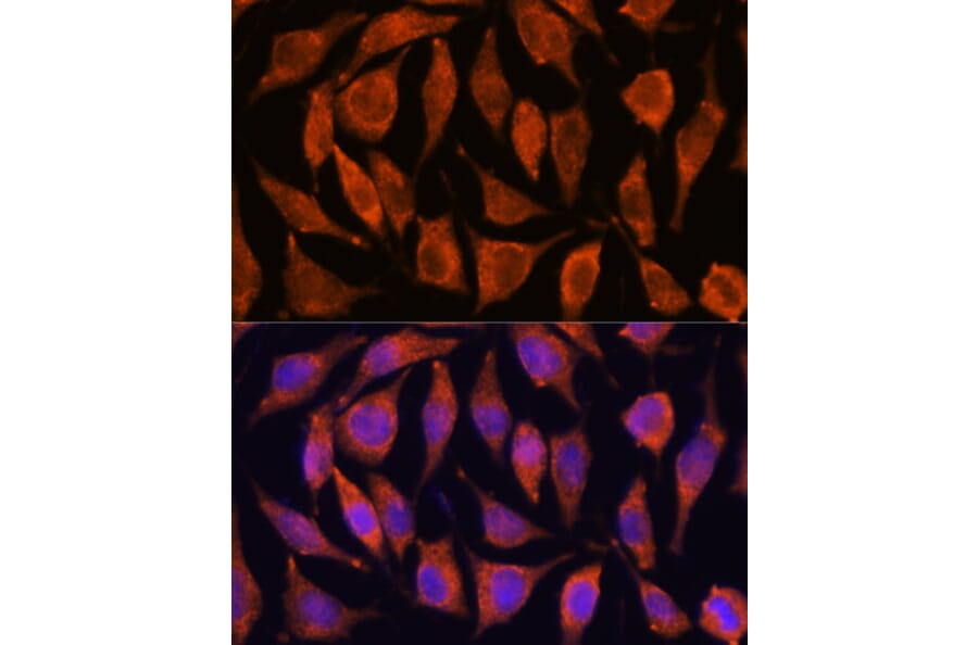 Immunofluorescence - Anti-TIPE2 Antibody (A88707) - Antibodies.com