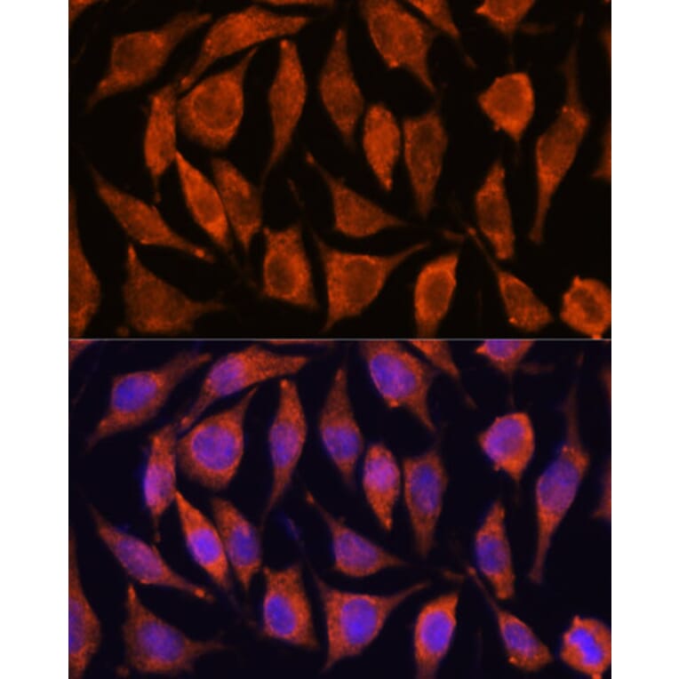 Immunofluorescence - Anti-TIPE2 Antibody (A88707) - Antibodies.com