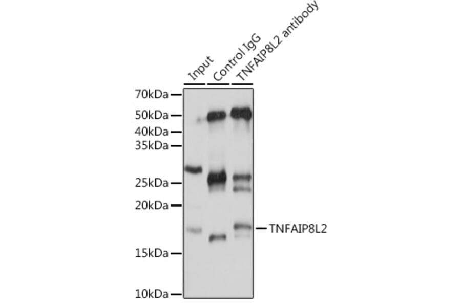 Western Blot - Anti-TIPE2 Antibody (A88707) - Antibodies.com