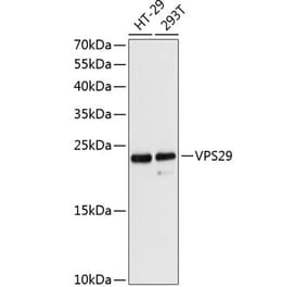 Western Blot - Anti-VPS29 Antibody (A88708) - Antibodies.com