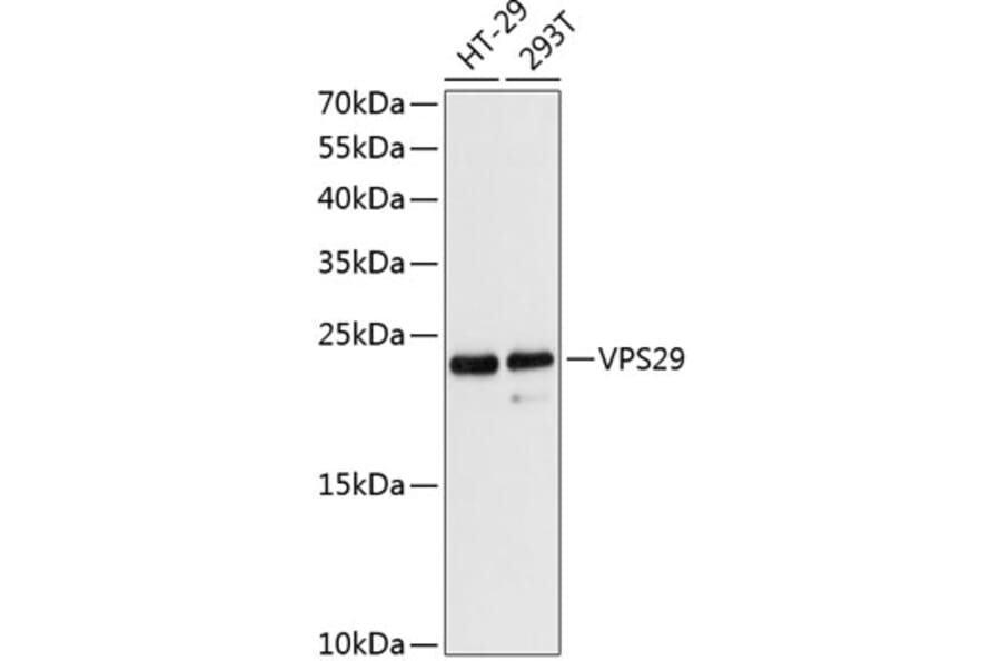 Western Blot - Anti-VPS29 Antibody (A88708) - Antibodies.com