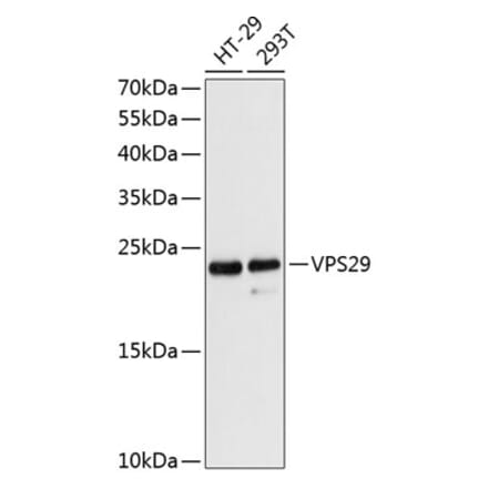 Western Blot - Anti-VPS29 Antibody (A88708) - Antibodies.com