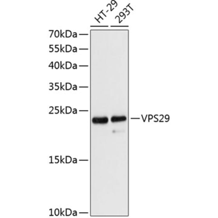 Western Blot - Anti-VPS29 Antibody (A88708) - Antibodies.com