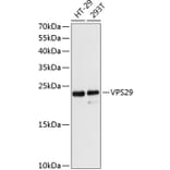 Western Blot - Anti-VPS29 Antibody (A88708) - Antibodies.com