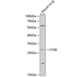 Western Blot - Anti-Cytoglobin Antibody (A88709) - Antibodies.com