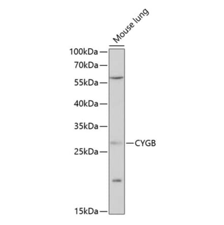 Western Blot - Anti-Cytoglobin Antibody (A88709) - Antibodies.com